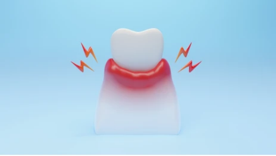 Causes of Swelling 2 Weeks After Dental Bone Graft