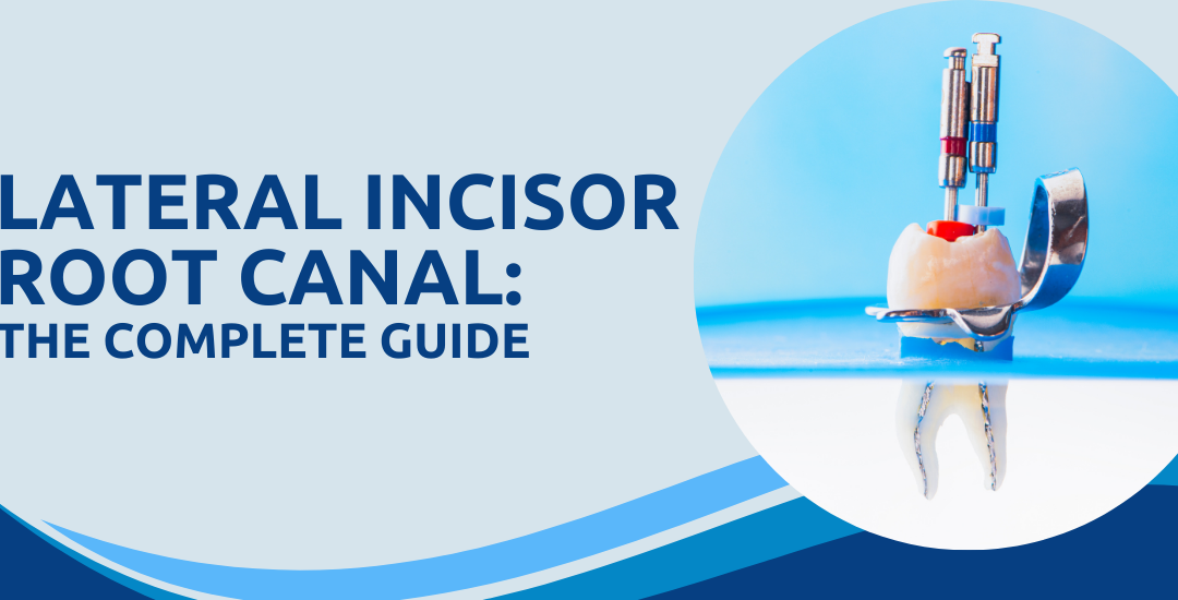 Lateral incisor root canal: The complete guide