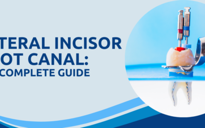 Lateral incisor root canal: The complete guide