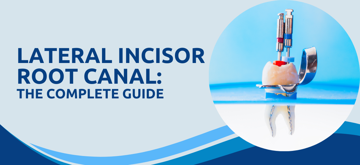 Lateral incisor root canal: The complete guide