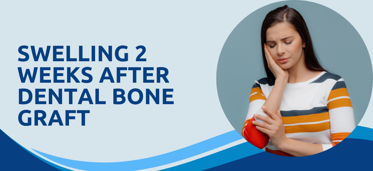 Swelling 2 Weeks After Dental Bone Graft