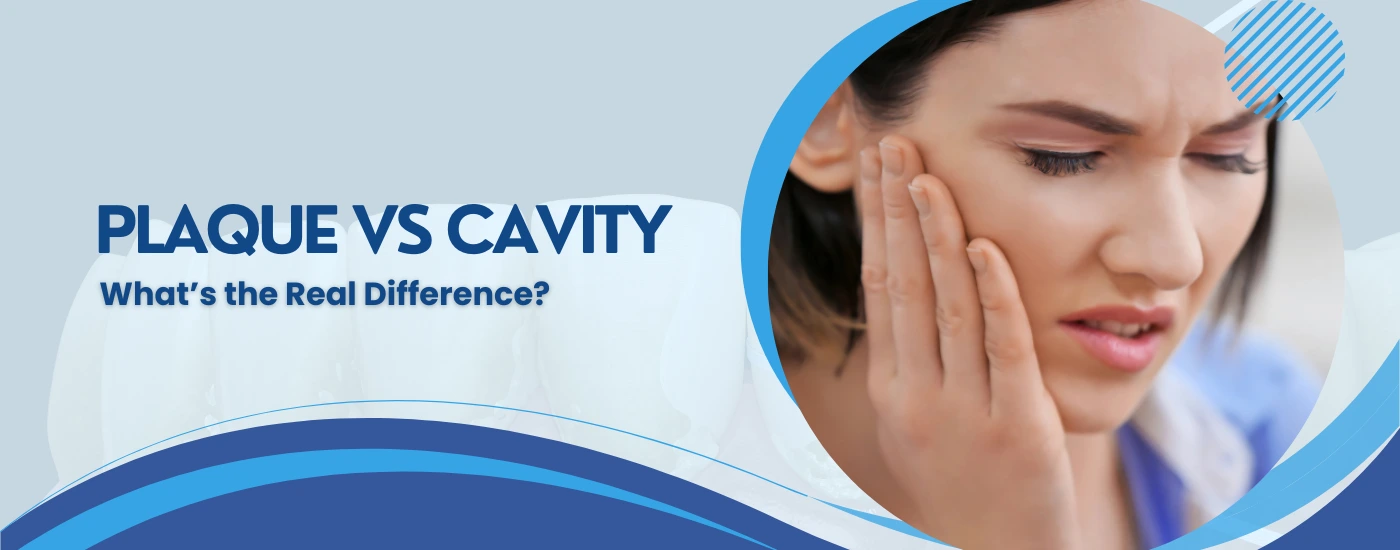 Plaque vs Cavity – What’s the Real Difference?