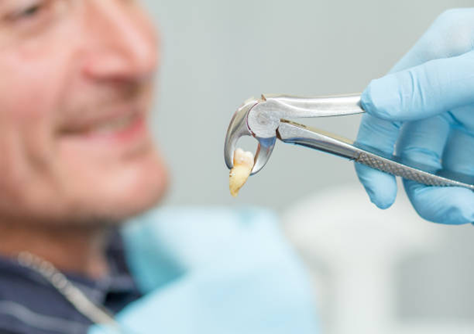 Root Canal Treatment