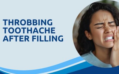 Throbbing Toothache After Filling