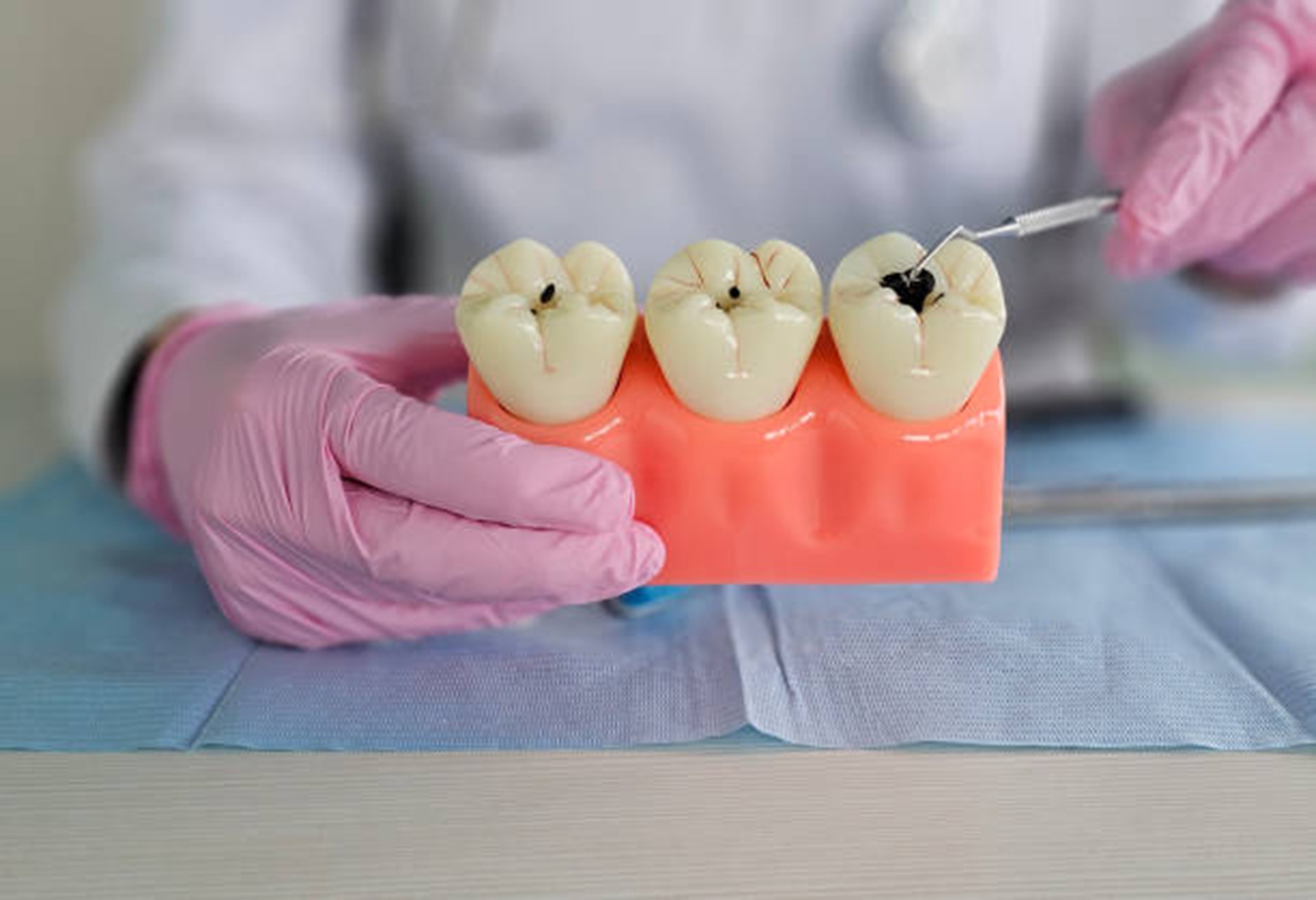 Root Canal Treatment