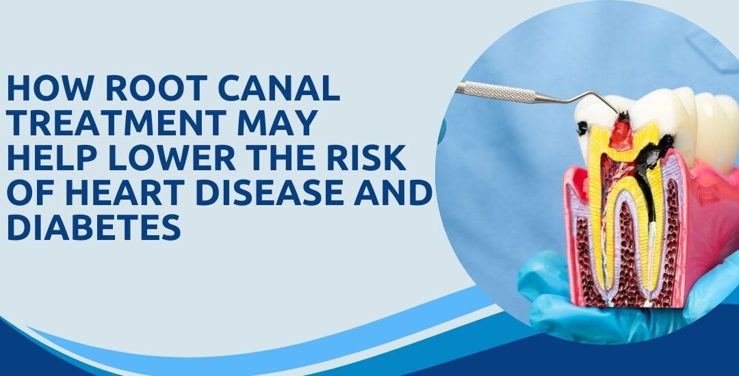 How Root Canal Treatment Can Reduce the Risk of Heart Disease and Diabetes