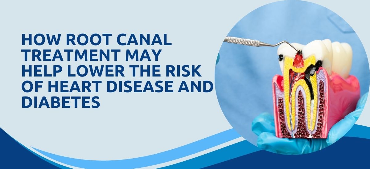 How Root Canal Treatment Can Reduce the Risk of Heart Disease and Diabetes