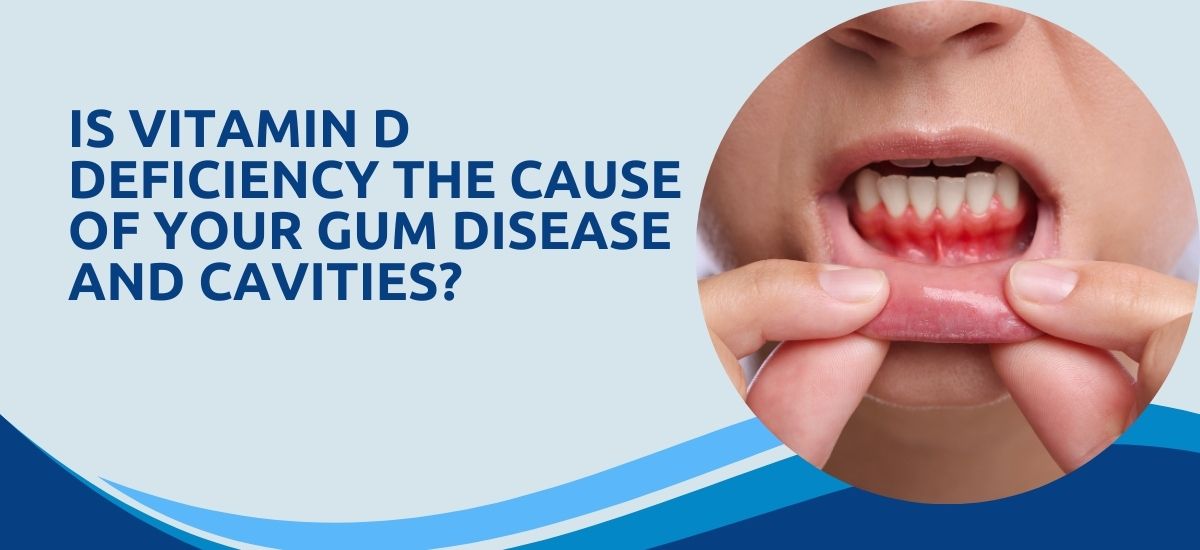 Is Vitamin D Deficiency the Cause of Your Gum Disease and Cavities?