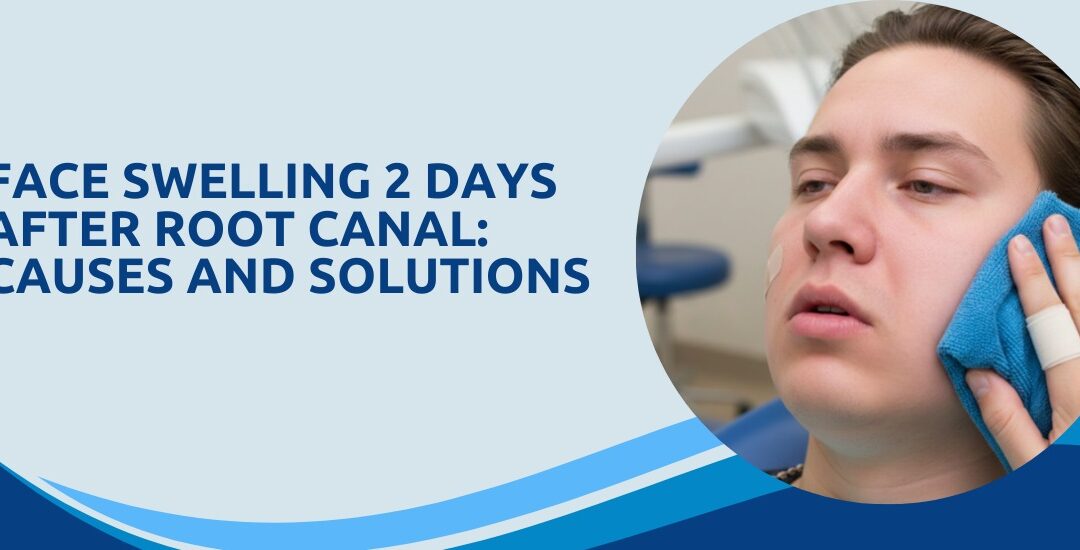 Face Swelling 2 Days After Root Canal: Causes and Solutions