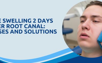 Face Swelling 2 Days After Root Canal: Causes and Solutions