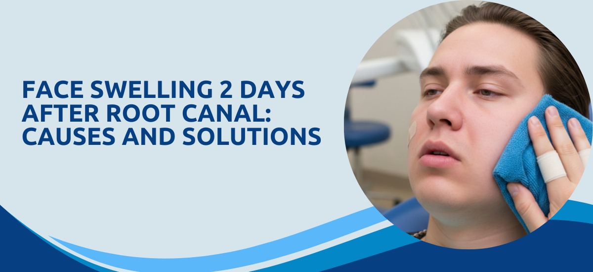 Face Swelling 2 Days After Root Canal: Causes and Solutions