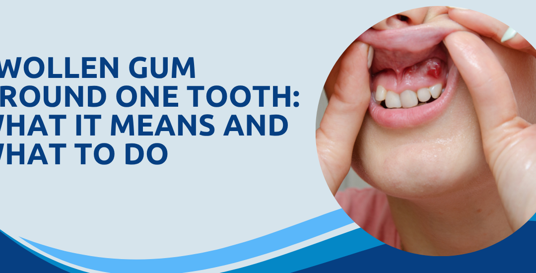 Swollen Gum Around One Tooth: What It Means and What to Do