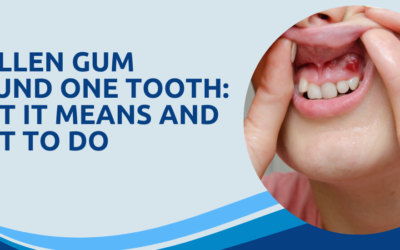 Swollen Gum Around One Tooth: What It Means and What to Do