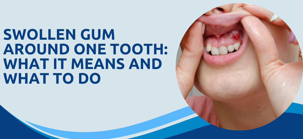 Swollen Gum Around One Tooth: What It Means and What to Do