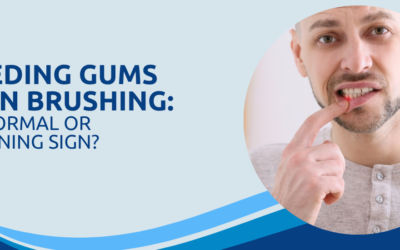 Bleeding Gums When Brushing: Is It Normal or a Warning Sign?