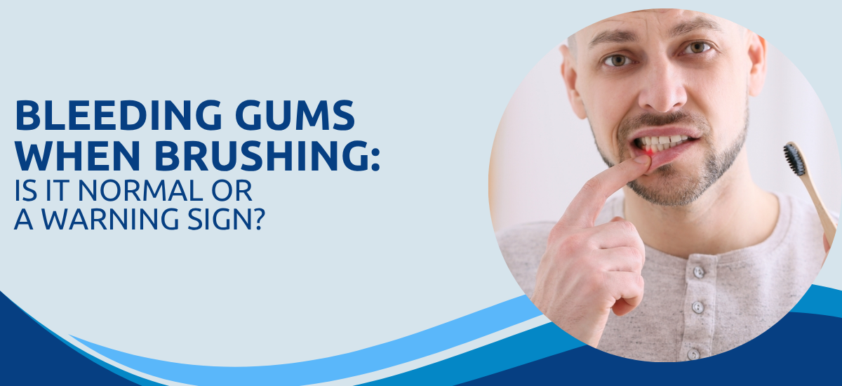 Bleeding Gums When Brushing: Is It Normal or a Warning Sign?