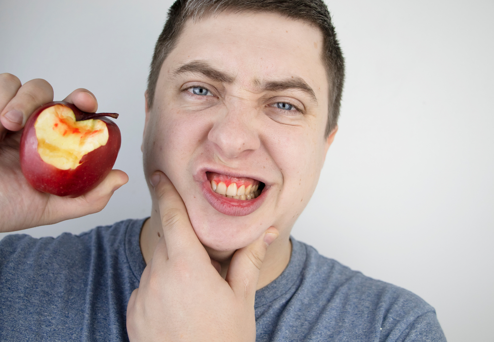 Man holding a bitten red apple near his mouth while grimacing and pressing his cheek with his fingers.