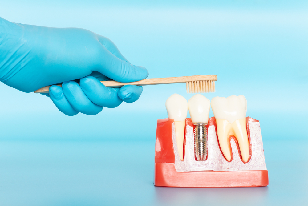 Gloved hand brushes a dental implant model with a toothbrush near artificial teeth on a blue background.