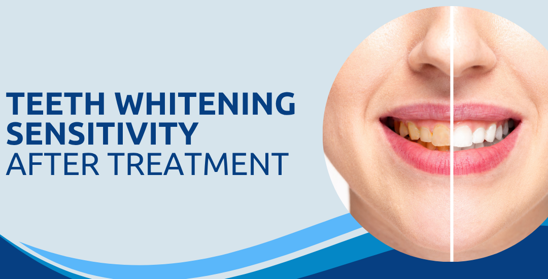 Does Teeth Whitening Sensitivity Last After Treatment?
