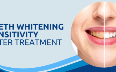 Does Teeth Whitening Sensitivity Last After Treatment?