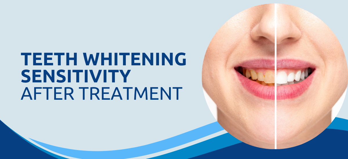 Does Teeth Whitening Sensitivity Last After Treatment?