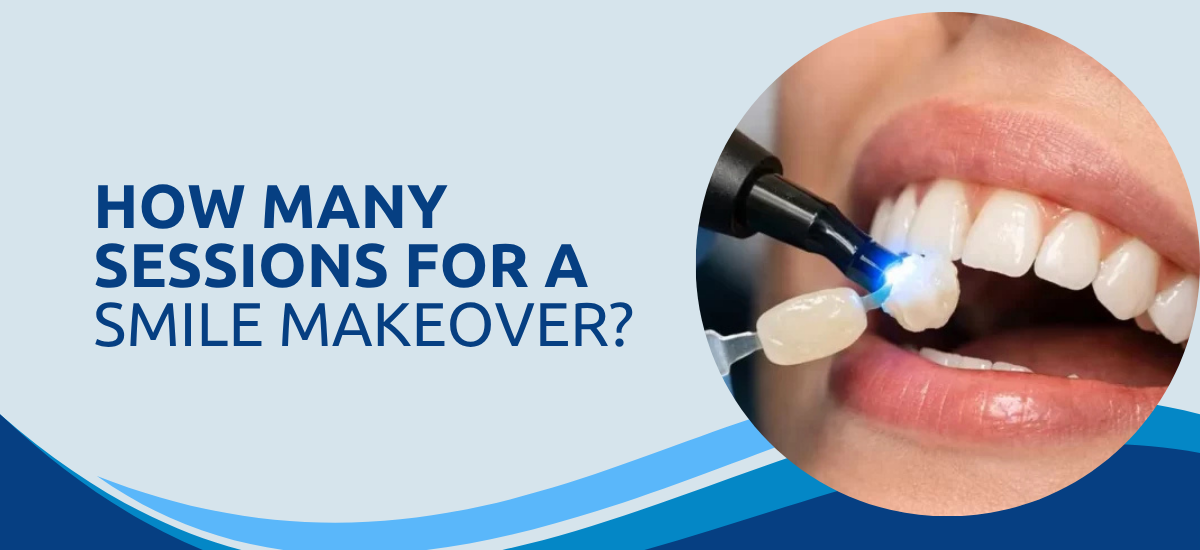 How Many Sessions for a Smile Makeover?