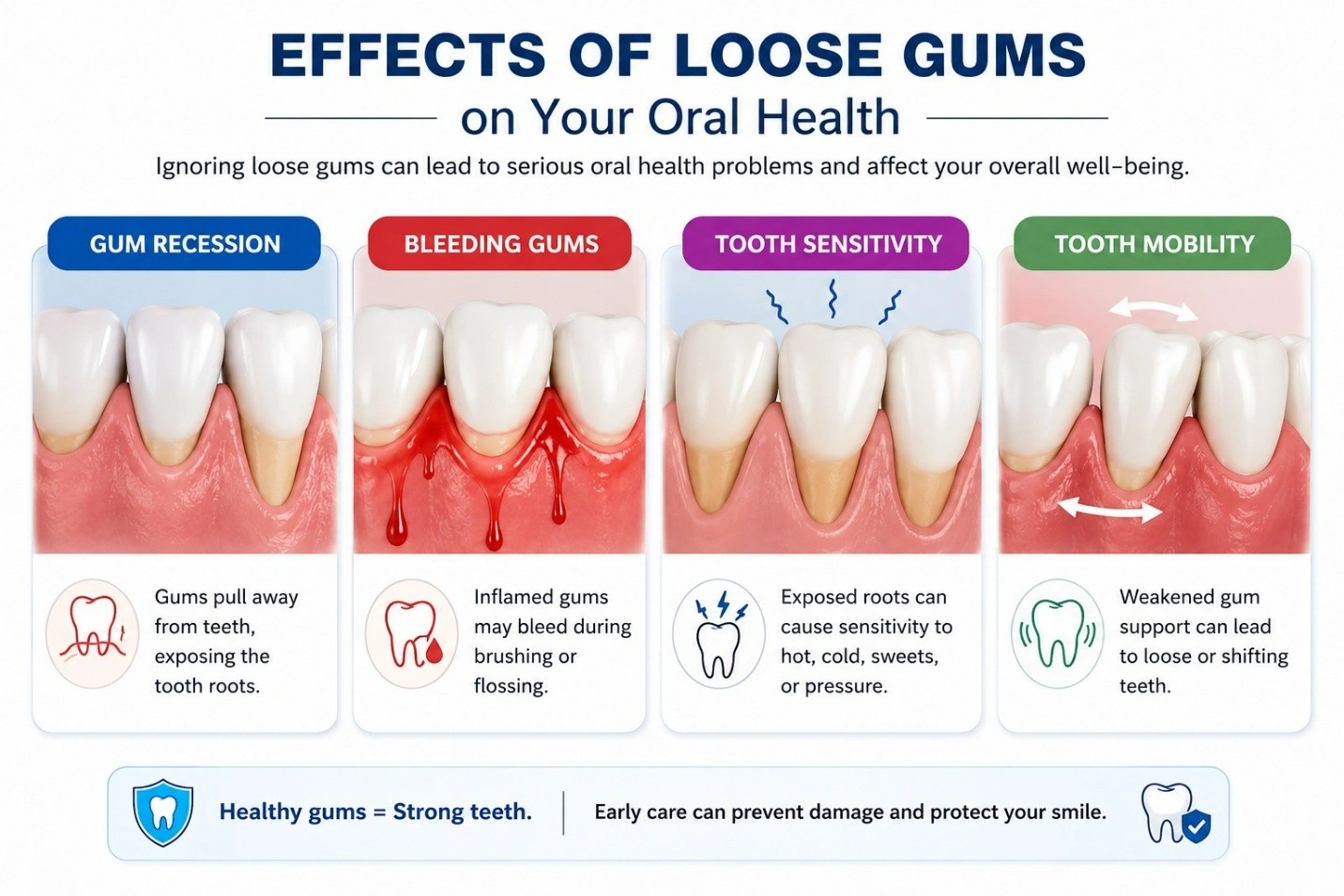 Gum recession: gums pull away from teeth, exposing the roots beneath the enamel.