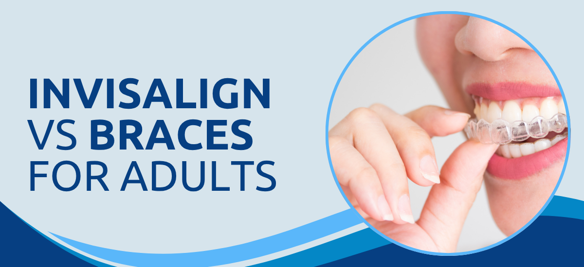 Invisalign vs Braces: Which Is Better for Adults?