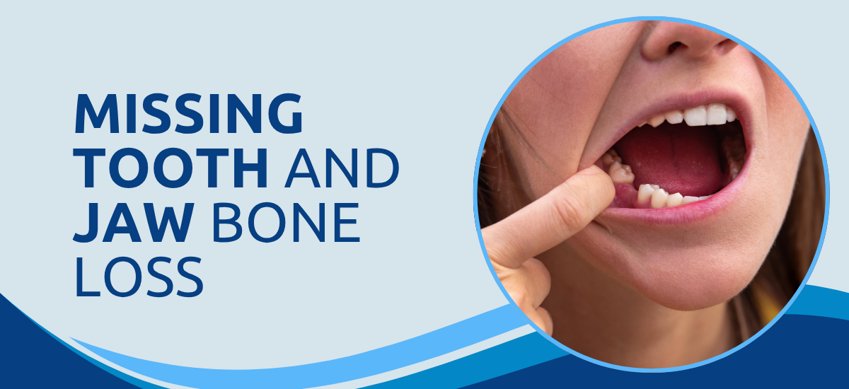 Can a Missing Tooth Cause Bone Loss in the Jaw