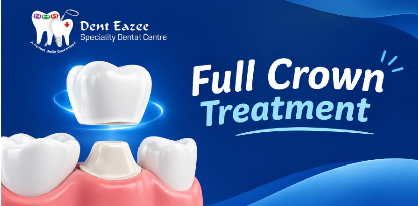 Full Crown Treatment: The Complete Guide to Dental Crowns