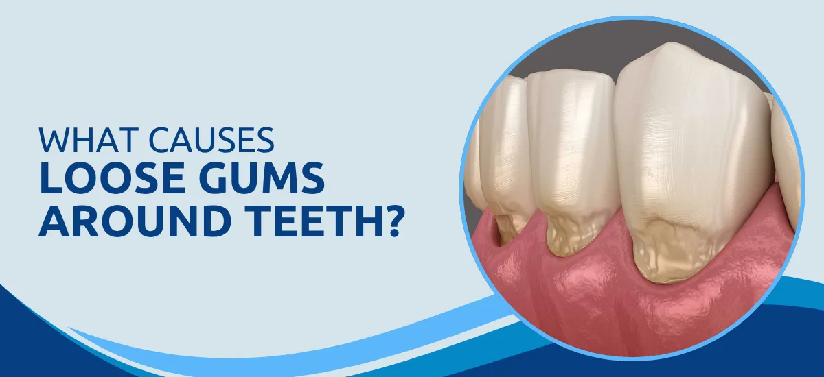 Loose Gums Around Teeth: Causes, Symptoms, and Ways to Protect Your Oral Health