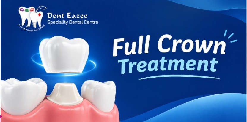 Full Crown Treatment: The Complete Guide to Dental Crowns