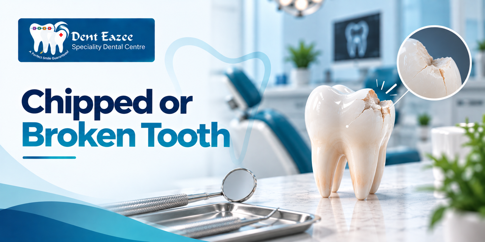 Chipped or Broken Tooth? What to Do Right Now and How to Fix It in Adyar