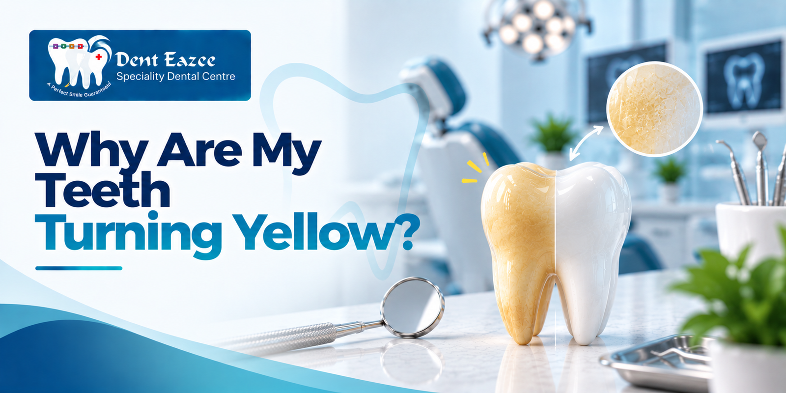 Why Are My Teeth Turning Yellow? Causes and Treatments in Adyar