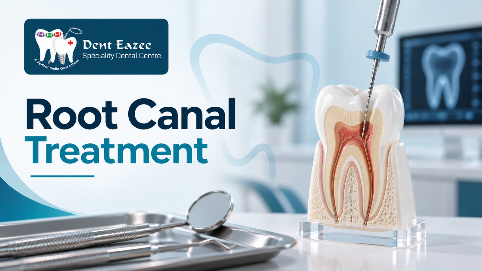 Root Canal Treatment in Adyar: Symptoms, Procedure, Cost & the Best Dental Clinic in Adyar