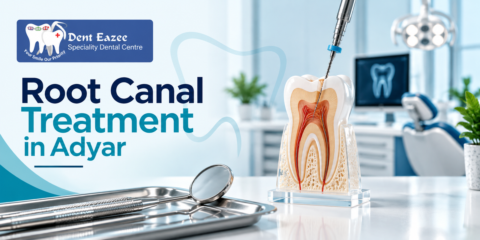 Root Canal Treatment in Adyar: The Complete Guide to Saving an Infected Tooth