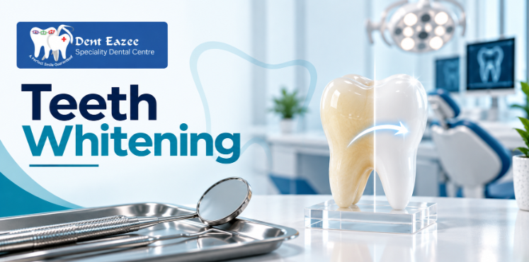 Teeth Whitening in Adyar: The Complete Guide to a Brighter Smile